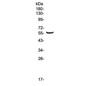 Western blot testing of human A375 cell lysate with TRIM5 antibody at 0.5ug/ml. Predicted molecular