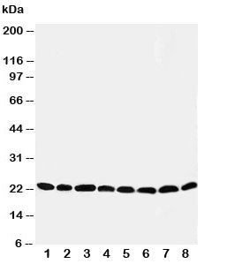 Peroxiredoxin 5 Antibody (PRDX5)