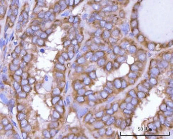 NANP Antibody / N-acylneuraminate-9-phosphatase