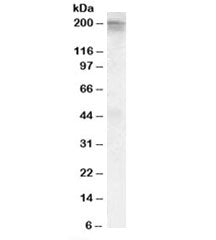 CACNA1C Antibody
