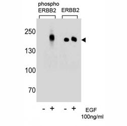 HER2 Antibody (ERBB2) (phospho-Y1196)