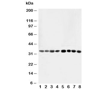 Western blot testing of AIMP2 antibody and Lane 1: rat liver; 2: rat lung; 3: rat kidney; 4: rat brain; 5: Jurkat; 6: CEM; 7: HUT; 8: U93T; 10: U93T cell lysate