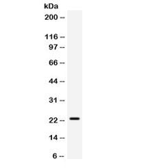 Western blot testing of mouse HEPA cell lysate with SECTM1 antibody. Expected/observed molecular wei
