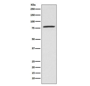Western blot testing of human K562 cell lysate with 5-Lipoxygenase antibody. Predicted molecular weight ~78 kDa.