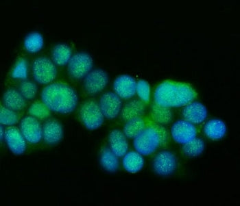 Presenilin 1 Antibody