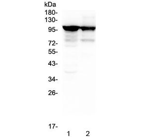 ACTN3 Antibody / Alpha Actinin 3