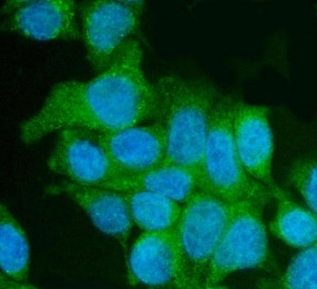 Utrophin Antibody / UTRN