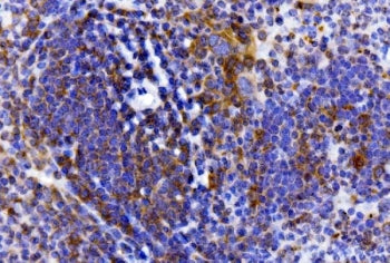 Cd25 Antibody / IL2ra
