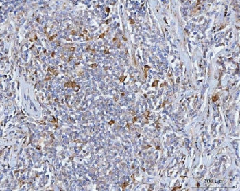 BCAT1 Antibody