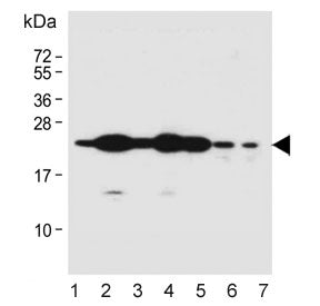 RAB1B Antibody