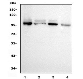 Ubiquitin-protein ligase E3A Antibody / UBE3A