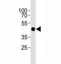 HA Antibody