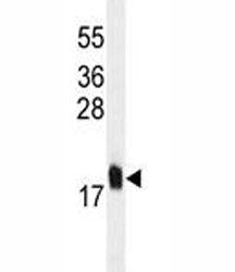MCFD2 Antibody, 0.08ml