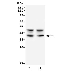 Western blot testing of 1) human Raji and 2) mouse NIH3T3 cell lysate with AIM2 antibody. Expected m