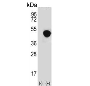 LRG1 Antibody / Leucine-rich alpha-2-glycoprotein