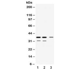 Western blot testing of 1) rat kidney, 2) mouse kidney and 3) human HeLa lysate with DDAH1 antibody