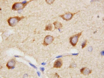 PPID Antibody