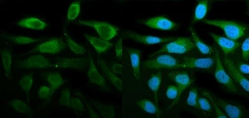 STAT1 Antibody