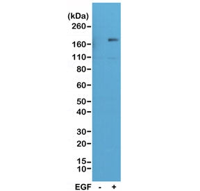 Phospho-EGF Receptor / EGFR Antibody (pY1173)