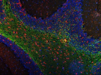 MAG Antibody / Myelin-associated glycoprotein