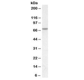 Western blot testing of human skeletal muscle lysate with MTM1 antibody at 1ug/ml. Predicted molecul