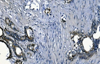 PCBP2 Antibody
