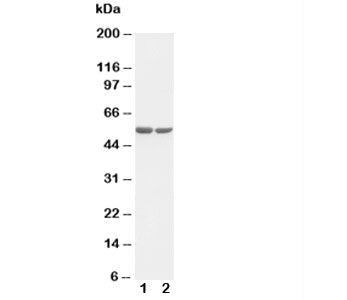 Western blot testing of c-Fos antibody and Lane 1: HT1080; 2: COLO320 cell lysate. Expected molecula
