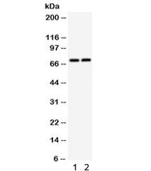 TNF Receptor II Antibody / TNFR2