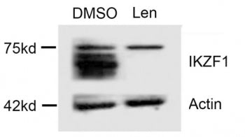 IKAROS Antibody / IKZF1