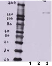 Western blot of MDCK lysate overexpressing mouse Btbd7 (lane 3) tested with BTBD7 antibody. Lane 1: