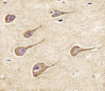 NPY2R Antibody