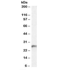 Western blot testing of human kidney lysate with BDH2 antibody at 0.3ug/ml. Predicted molecular weig