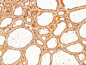 TG Antibody / Thyroglobulin