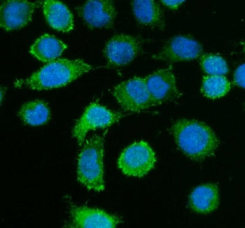 Immunofluorescent staining of FFPE human SiHa cells with Caldesmon antibody (green) and DAPI nuclear