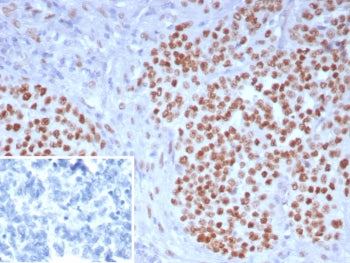 WT1 Antibody / Wilms Tumor 1