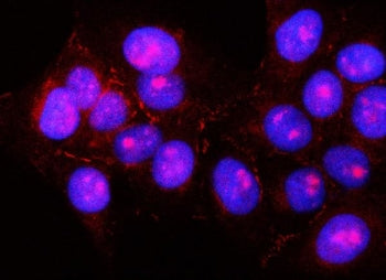 PNLIPRP2 Antibody / Pancreatic lipase-related protein 2