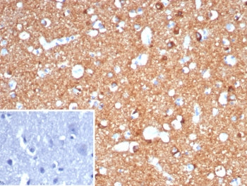 IHC staining of FFPE human brain tissue with CD91 / LRP1 antibody (clone LRP1/7152) Inset: PBS used
