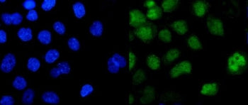 Immunofluorescent staining of FFPE human A431 cells with Pokemon antibody (green) and DAPI nuclear s
