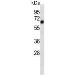 ACVR1 Antibody / ALK2