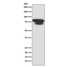 PIAS1/2/3 Antibody