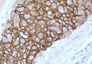 HER2 Antibody / ErbB2