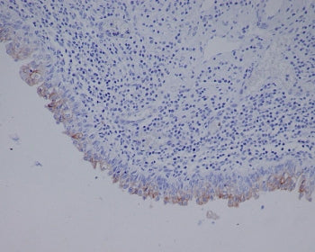 Uroplakin 3a Antibody / UPK3A