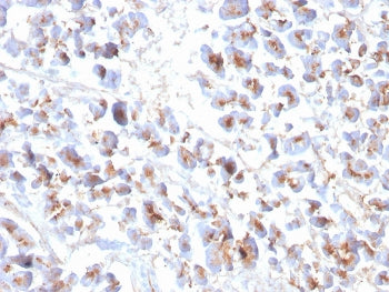 Eosinophil Peroxidase Antibody