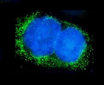 Tissue-nonspecific Alkaline Phosphatase Antibody / ALPL