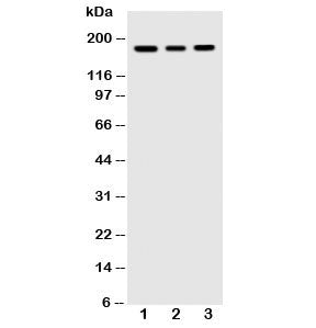 VEGFR Antibody