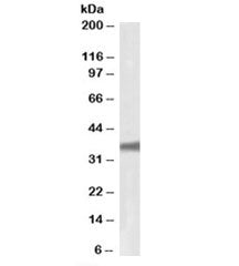 GNB3 Antibody