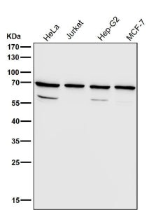 Western blot testing of human samples using the RPN1 antibody at 1:3000 dilution for 1 hour at room