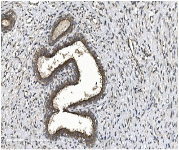 EIF2B1 Antibody