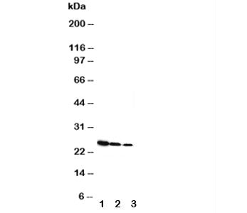 Growth Hormone Antibody (Rat)