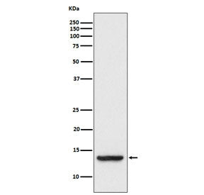 TAX1BP3 Antibody / TIP-1